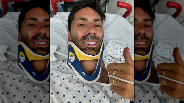 Nev Schulman con collarín tras una caída en bicicleta
