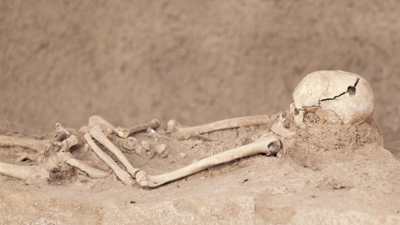 Trepanning para tratar la depresión